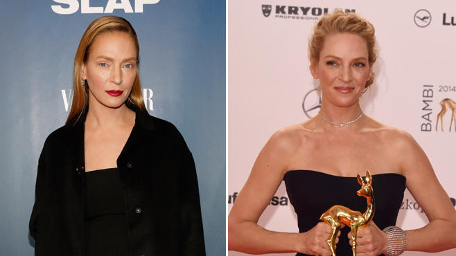 Uma Thurman Botox